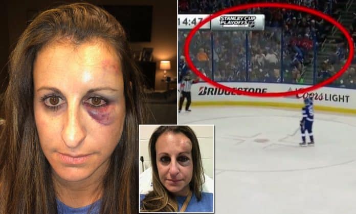 ***COMPOSITE*** Florida woman hit in the face with a puck at NHL playoff game
